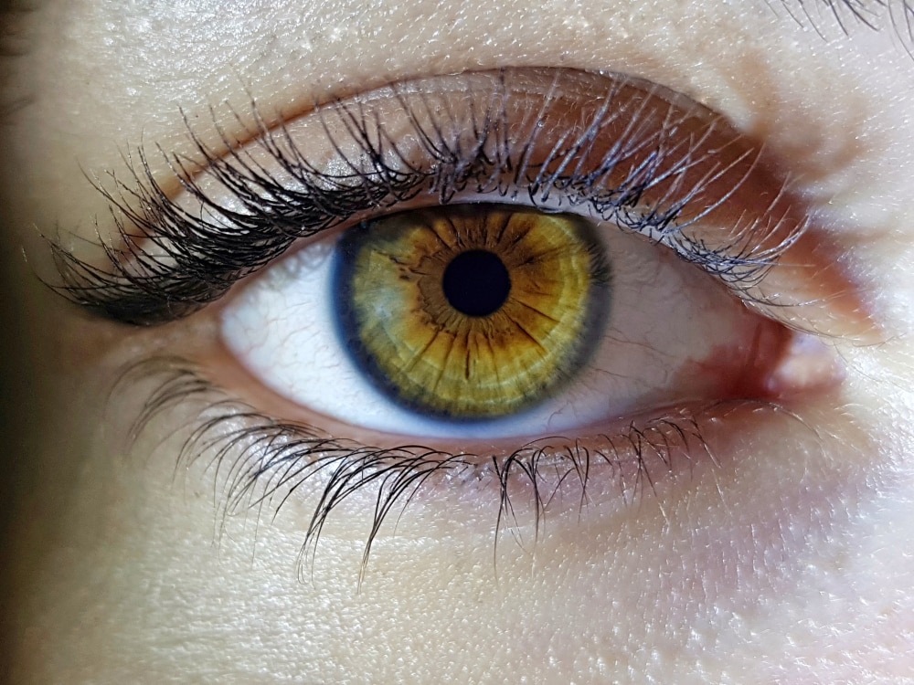 sindrome dell'occhio secco